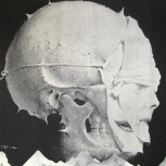 Franciszek Starowieyski Kraska thumbnail